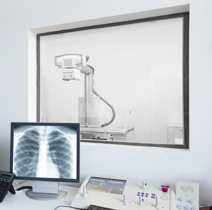 Lülisamba röntgenuuring - peamine meetod osteokondroosi diagnoosimiseks