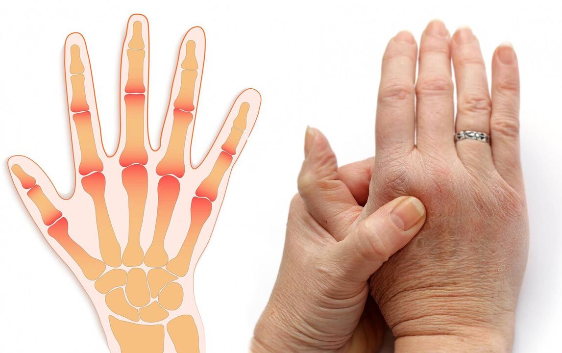 sõrmehaigused