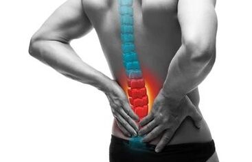 Osteokondroos on lülisamba haigus