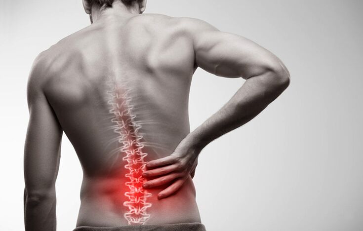 osteokondroosist tingitud alaseljavalu